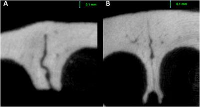 Age-related transversal changes in craniofacial sutures of the anterior viscerocranium in growing rats